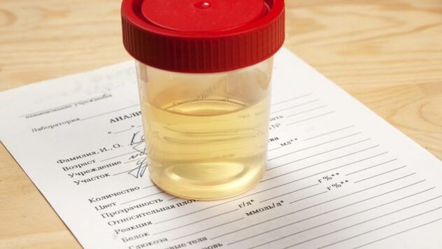 Analysis of urine for arterial hypertension